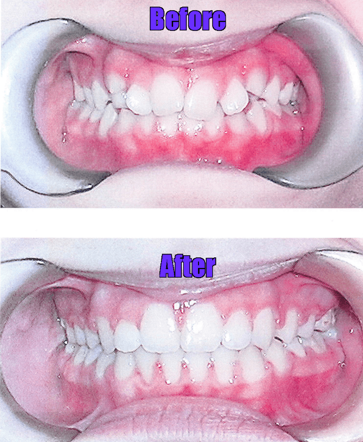 Zand Ortho before after 2 (1)