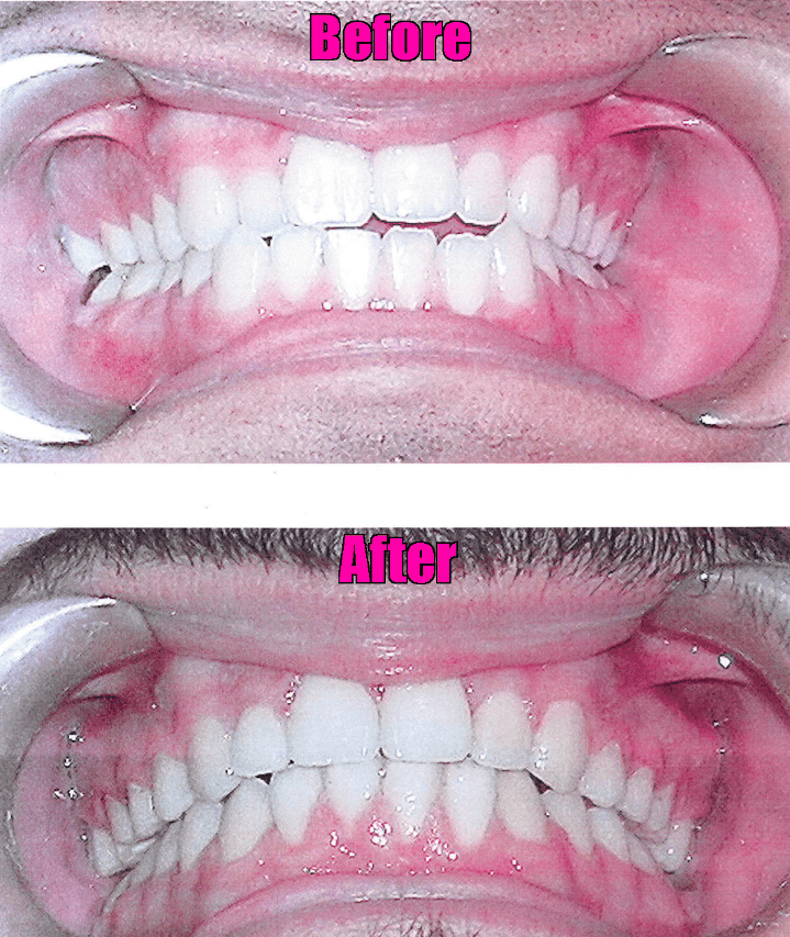Zand Ortho before after 3 (1)