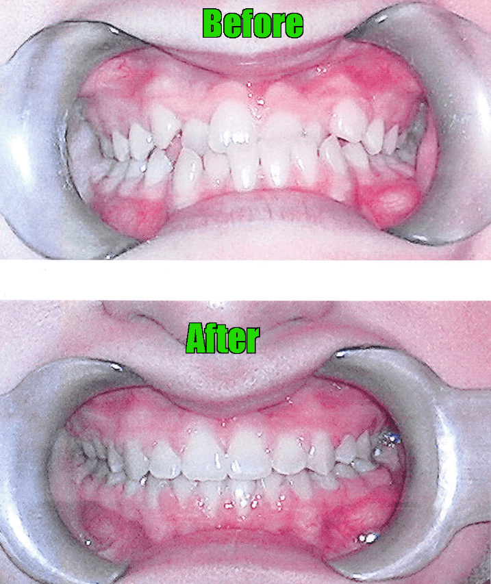 Zand Ortho before after 4 (1)